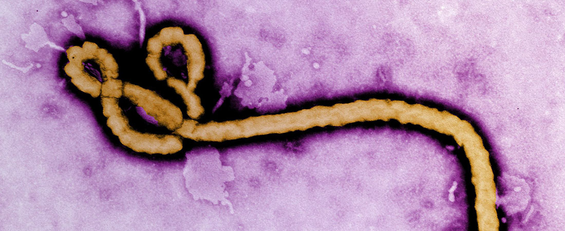 Ebola virus, photo courtesy of the CDC Ebola virus, photo courtesy of the CDC